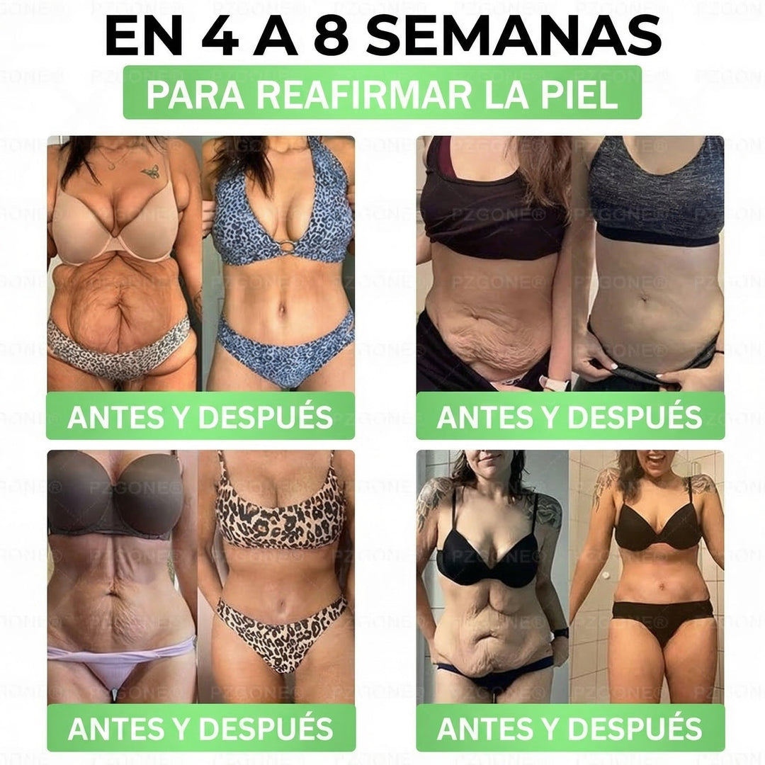 𝑳𝒖𝒙𝒂𝒓𝒊𝒔𝒆/ Moringa & Berberina 2X1